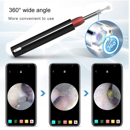 High-Definition Visual Ear Scoop - Wireless Ear Cleaning Tool & Oral Endoscope with 5MP Camera, 3.9mm Lens, and 6 LED Lights