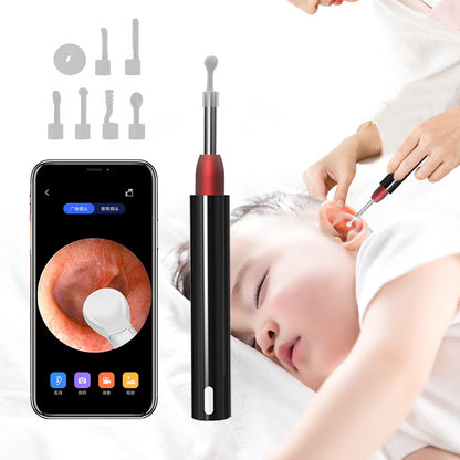 High-Definition Visual Ear Scoop - Wireless Ear Cleaning Tool & Oral Endoscope with 5MP Camera, 3.9mm Lens, and 6 LED Lights